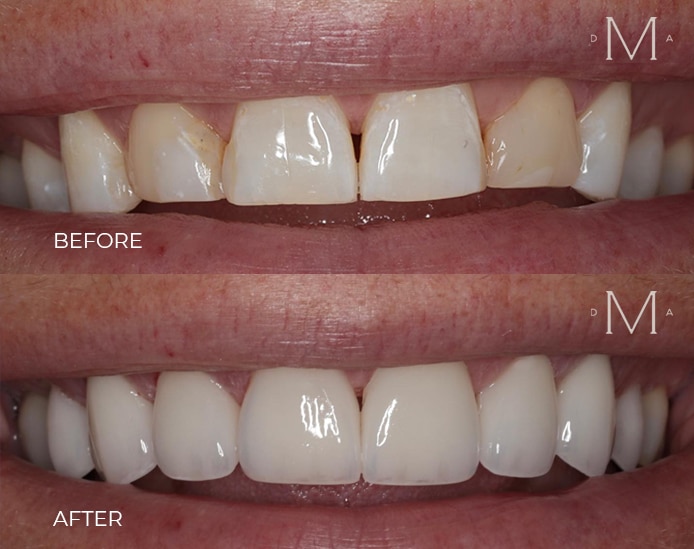 General Dentistry in Peabody