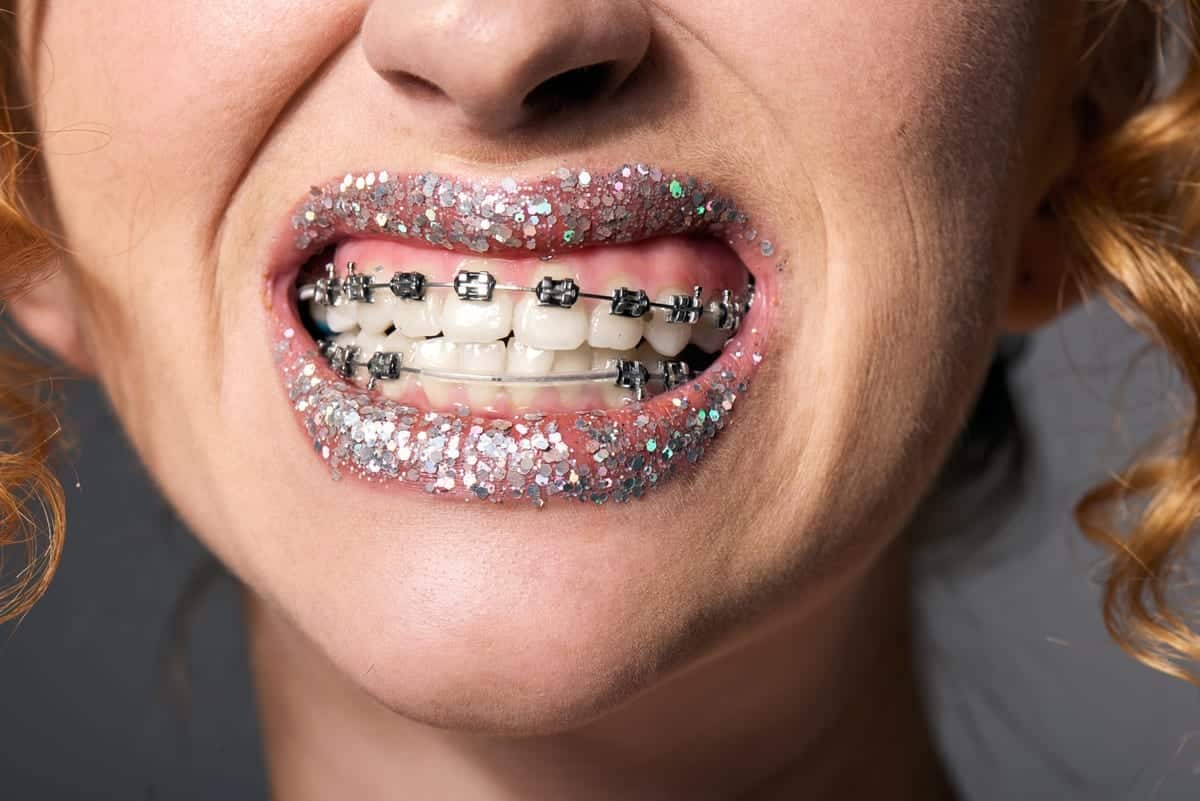 Orthodontics in Peabody